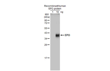 Anti-EPO antibody used in Western Blot (WB). GTX100813