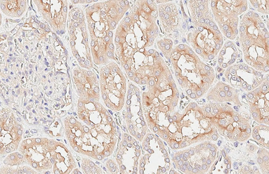Anti-Alkaline Phosphatase (Tissue Non-Specific) antibody used in IHC (Paraffin sections) (IHC-P). GTX100817
