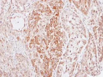 Anti-HMW Kininogen antibody used in IHC (Paraffin sections) (IHC-P). GTX100833