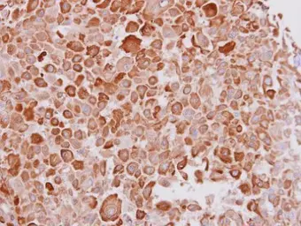 Anti-Cytokeratin 16 antibody [C2C3], C-term used in IHC (Paraffin sections) (IHC-P). GTX100838