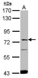 Anti-ACSVL4 antibody [N1N3] used in Western Blot (WB). GTX100842