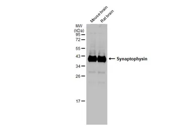 Anti-Synaptophysin antibody used in Western Blot (WB). GTX100865