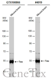 Anti-Tau antibody used in Western Blot (WB). GTX100866