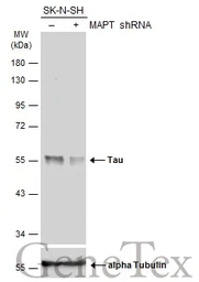 Anti-Tau antibody used in Western Blot (WB). GTX100866