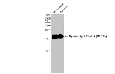 Anti-Myosin Light Chain 2 (MLC-2v) antibody used in Western Blot (WB). GTX100888