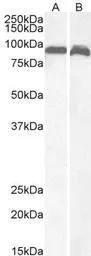 Anti-VPS35 antibody, C-term used in Western Blot (WB). GTX10099