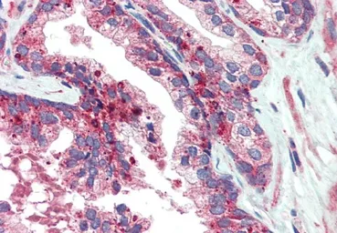 Anti-VPS35 antibody, C-term used in IHC (Paraffin sections) (IHC-P). GTX10099