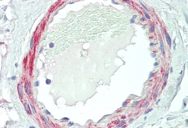Anti-VPS35 antibody, C-term used in IHC (Paraffin sections) (IHC-P). GTX10099