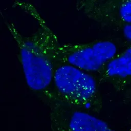 Anti-VPS35 antibody, C-term used in Immunocytochemistry/ Immunofluorescence (ICC/IF). GTX10099