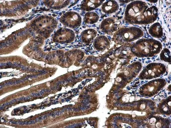 Anti-Angiopoietin 4 antibody used in IHC (Paraffin sections) (IHC-P). GTX100993