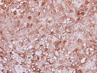 Anti-Angiopoietin 4 antibody used in IHC (Paraffin sections) (IHC-P). GTX100993