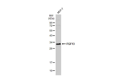 Anti-FGF13 antibody used in Western Blot (WB). GTX101008