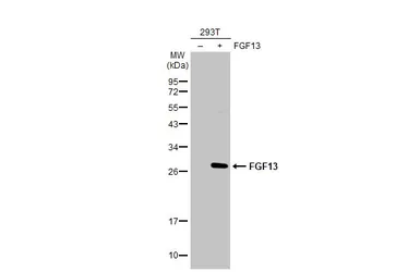 Anti-FGF13 antibody used in Western Blot (WB). GTX101008