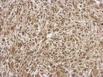 Anti-FGF13 antibody used in IHC (Paraffin sections) (IHC-P). GTX101008