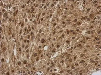 Anti-FGF13 antibody used in IHC (Paraffin sections) (IHC-P). GTX101008