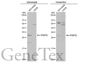 Anti-FGF13 antibody used in Western Blot (WB). GTX101008