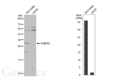 Anti-FGF13 antibody used in Western Blot (WB). GTX101008