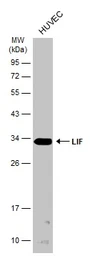 Anti-LIF antibody used in Western Blot (WB). GTX101021