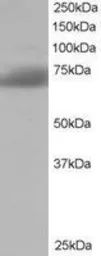 Anti-SH3BP1 antibody, C-term used in Western Blot (WB). GTX10103