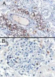 Anti-SH3BP1 antibody, C-term used in IHC (Paraffin sections) (IHC-P). GTX10103