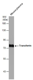 Anti-Transferrin antibody [N3C3] used in Western Blot (WB). GTX101035