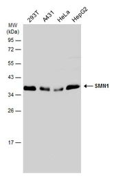 Anti-SMN1 antibody used in Western Blot (WB). GTX101047