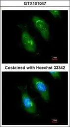Anti-SMN1 antibody used in Immunocytochemistry/ Immunofluorescence (ICC/IF). GTX101047