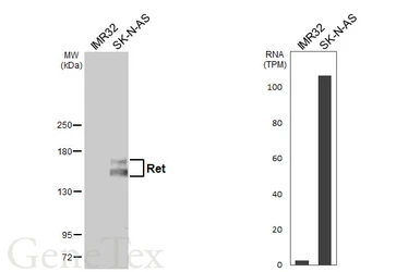 Anti-Ret antibody used in Western Blot (WB). GTX101059