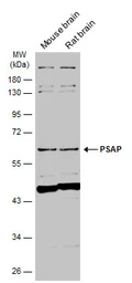 Anti-PSAP antibody [N1N3] used in Western Blot (WB). GTX101064