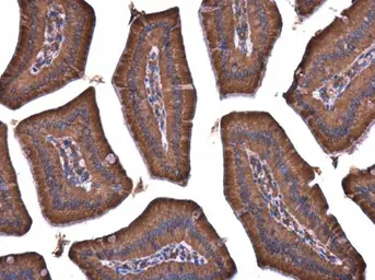 Anti-APAF1 antibody [C3], C-term used in IHC (Paraffin sections) (IHC-P). GTX101067
