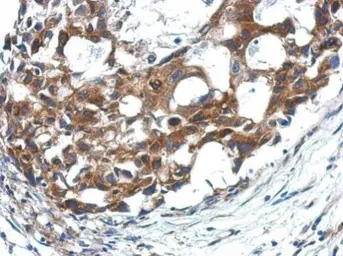 Anti-APAF1 antibody [C3], C-term used in IHC (Paraffin sections) (IHC-P). GTX101067