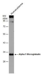 Anti-Alpha 1 Microglobulin antibody used in Western Blot (WB). GTX101068