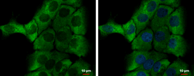 Anti-Alpha 1 Microglobulin antibody used in Immunocytochemistry/ Immunofluorescence (ICC/IF). GTX101068