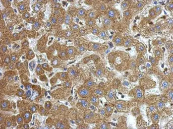 Anti-Alpha 1 Microglobulin antibody used in IHC (Paraffin sections) (IHC-P). GTX101068