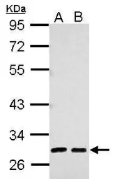 Anti-Alpha 1 Microglobulin antibody used in Western Blot (WB). GTX101068