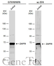 Anti-ZAP70 antibody used in Western Blot (WB). GTX101076