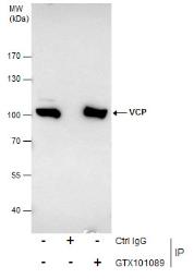 Anti-VCP antibody used in Immunoprecipitation (IP). GTX101089
