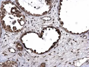 Anti-UBE3A antibody used in IHC (Paraffin sections) (IHC-P). GTX101092