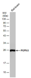 Anti-PGP9.5 antibody used in Western Blot (WB). GTX101093