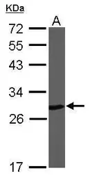 Anti-PGP9.5 antibody used in Western Blot (WB). GTX101093
