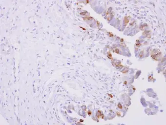 Anti-POR antibody [N1N3] used in IHC (Paraffin sections) (IHC-P). GTX101099