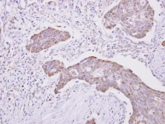 Anti-POR antibody [N2C2], Internal used in IHC (Paraffin sections) (IHC-P). GTX101100