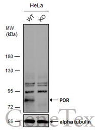 Anti-POR antibody [C2C3], C-term used in Western Blot (WB). GTX101101