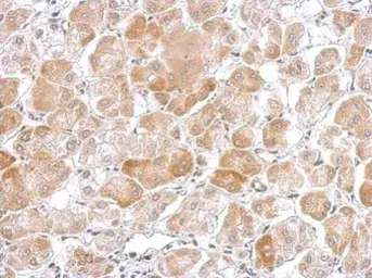 Anti-POR antibody [C2C3], C-term used in IHC (Paraffin sections) (IHC-P). GTX101101