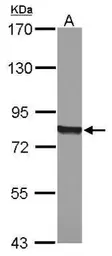 Anti-POR antibody [C2C3], C-term used in Western Blot (WB). GTX101101