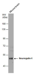 Anti-Neuregulin-1 antibody [C1C3] used in Western Blot (WB). GTX101116