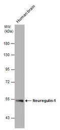 Anti-Neuregulin-1 antibody used in Western Blot (WB). GTX101117