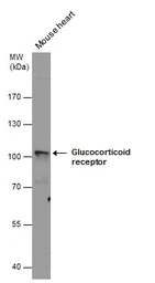 Anti-Glucocorticoid Receptor antibody used in Western Blot (WB). GTX101120