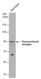 Anti-Glucocorticoid Receptor antibody used in Western Blot (WB). GTX101120
