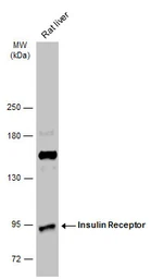 Anti-Insulin Receptor beta antibody used in Western Blot (WB). GTX101136
